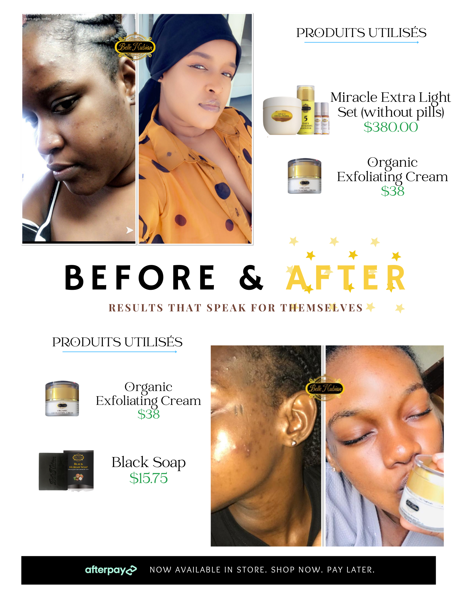 Miracle Extra White