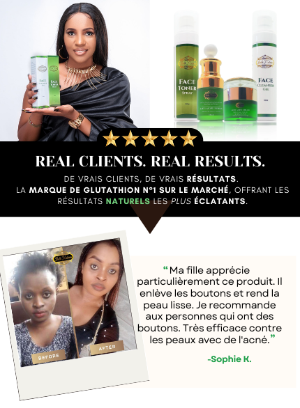 Crème Éclaircissante Anti-Acné Nettoyant Pour Taches Brunes