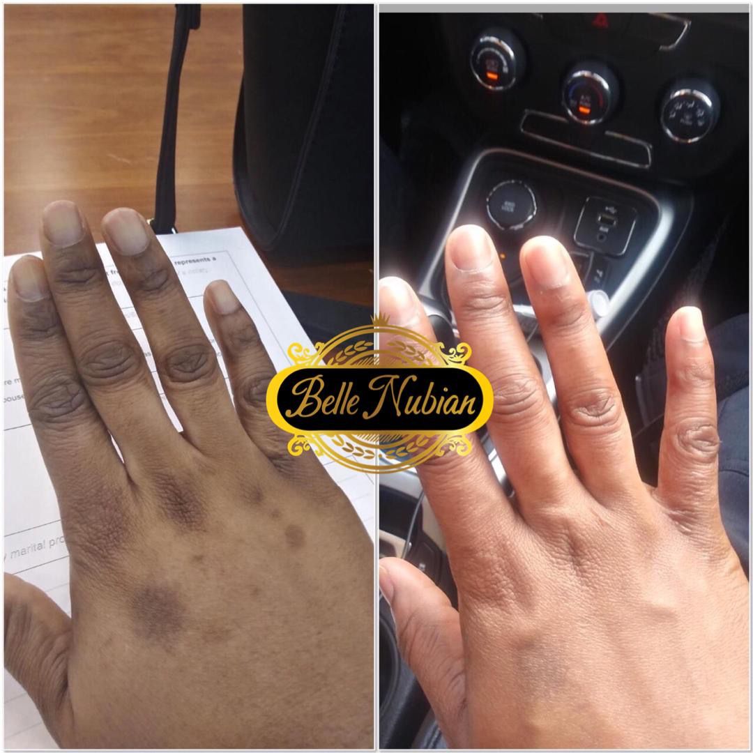 Extreme Hands & Feet Lightening Repair Kit