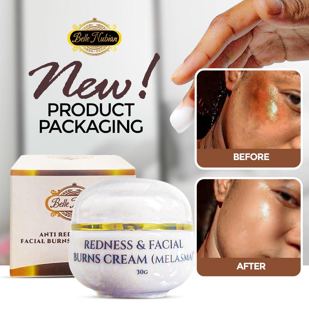 NEW Redness and Burn Face Cream