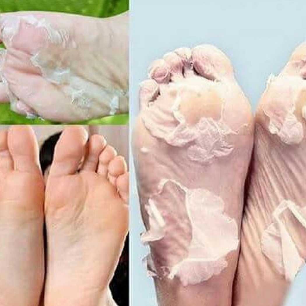 Extreme Hands & Feet Lightening Repair Kit