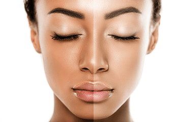 Organic Skin Whitening & Lightening VS Skin Bleaching: All you need to know
