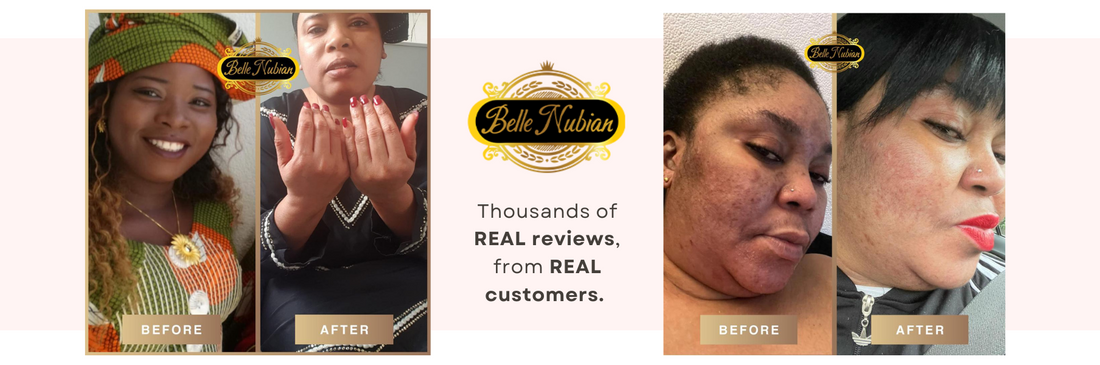 NEW Redness and Burn Face Cream