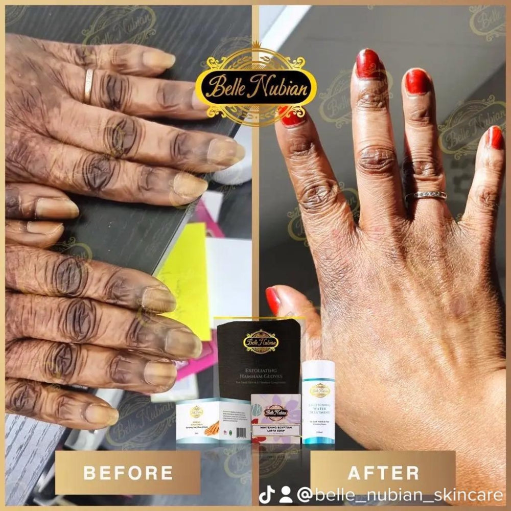 Extreme Dark Hands Feet Knees And Elbows Repair Cream