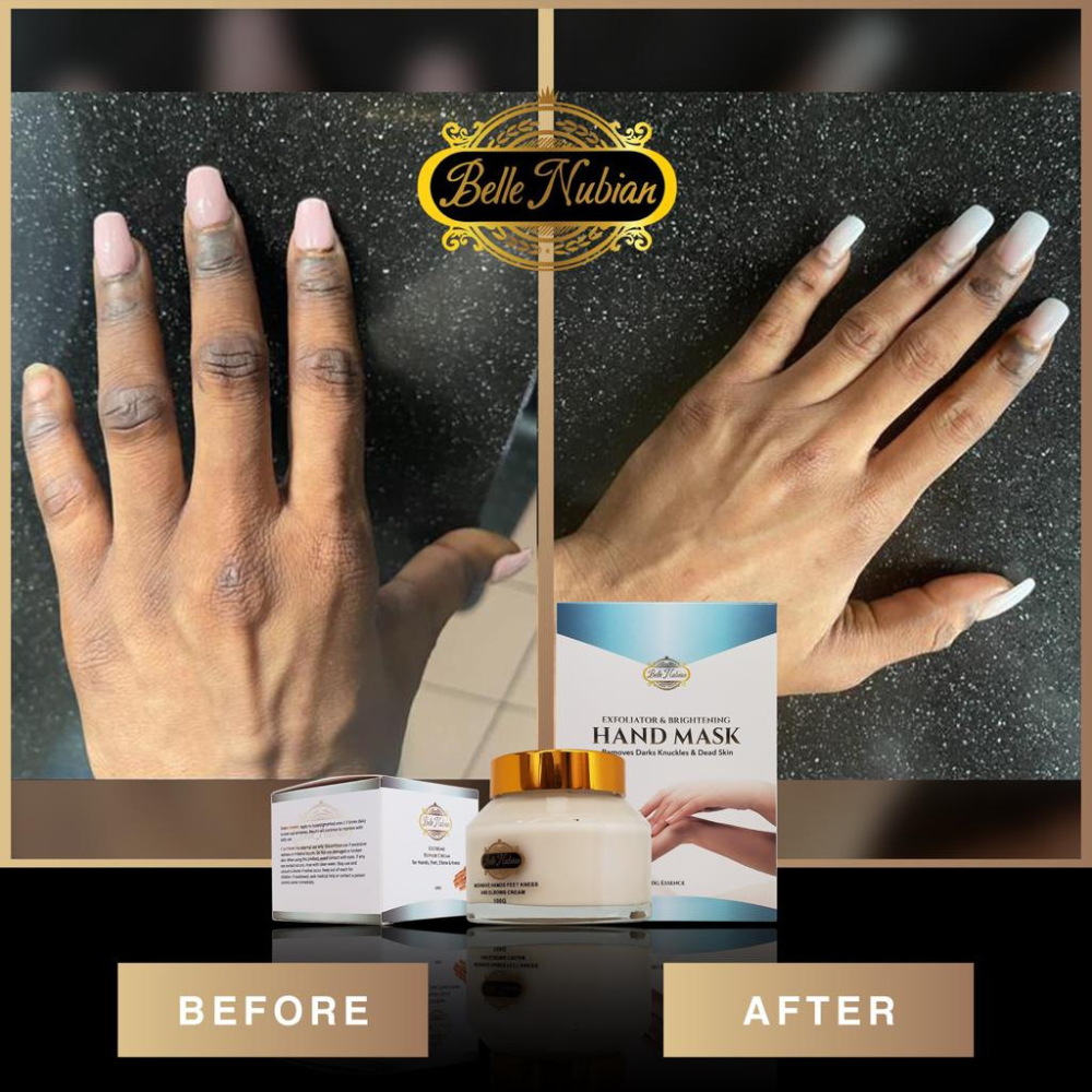 Extreme Dark Hands Feet Knees And Elbows Repair Cream