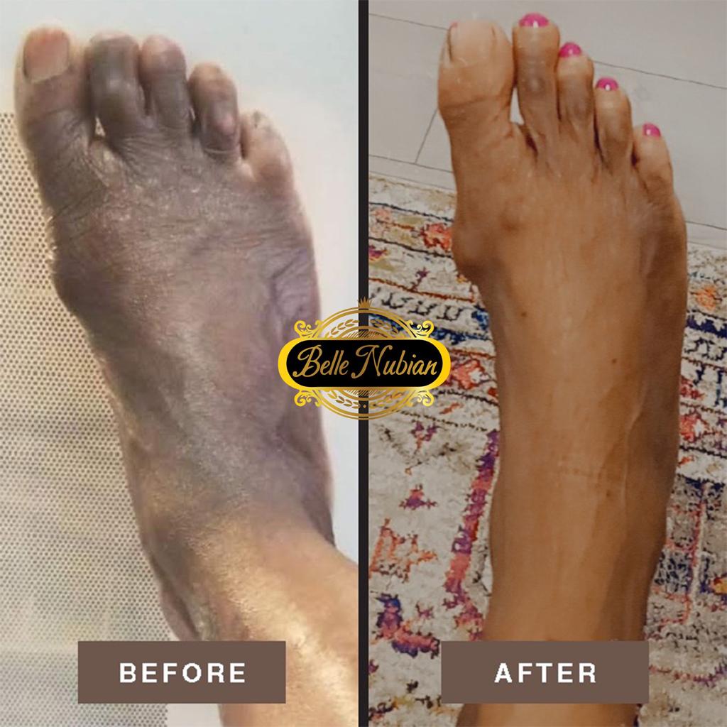 Extreme Dark Hands Feet Knees And Elbows Repair Cream