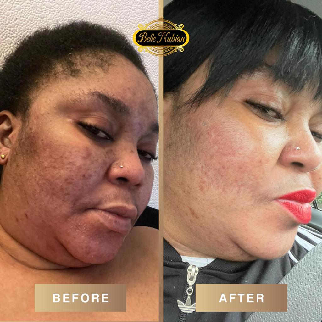 Perfect Face Kit (Kit Visage)