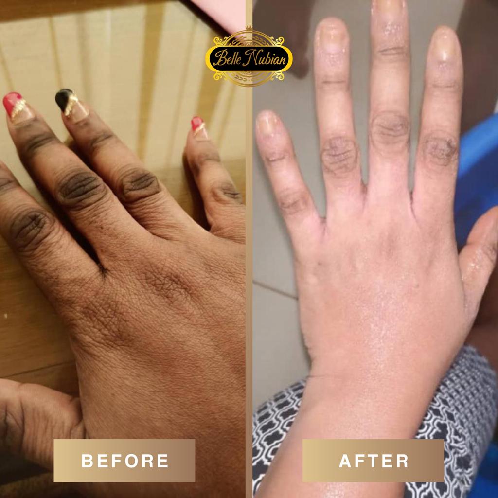 Extreme Dark Hands Feet Knees And Elbows Repair Cream