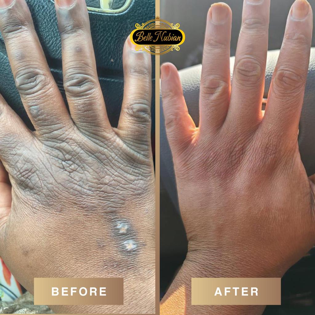 Extreme Dark Hands Feet Knees And Elbows Repair Cream