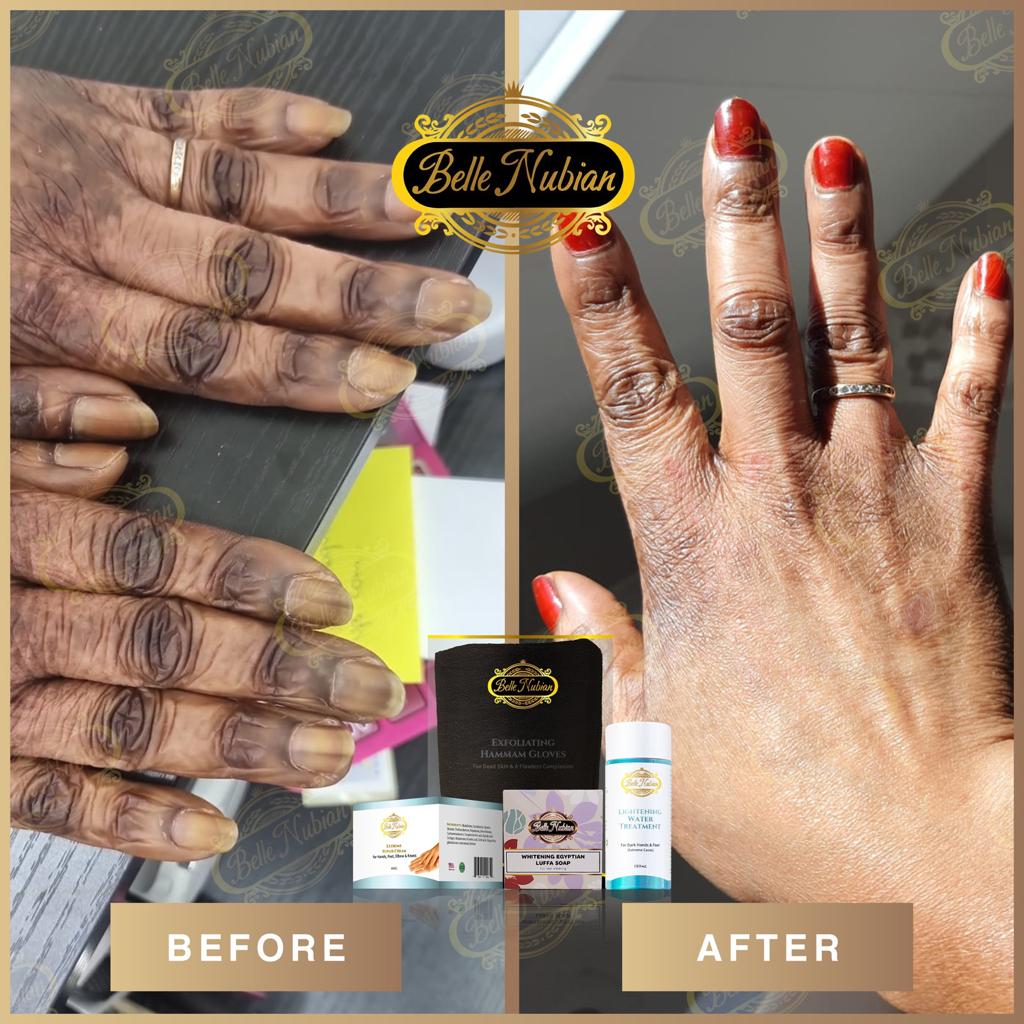 Extreme Dark Hands Feet Knees And Elbows Repair Cream