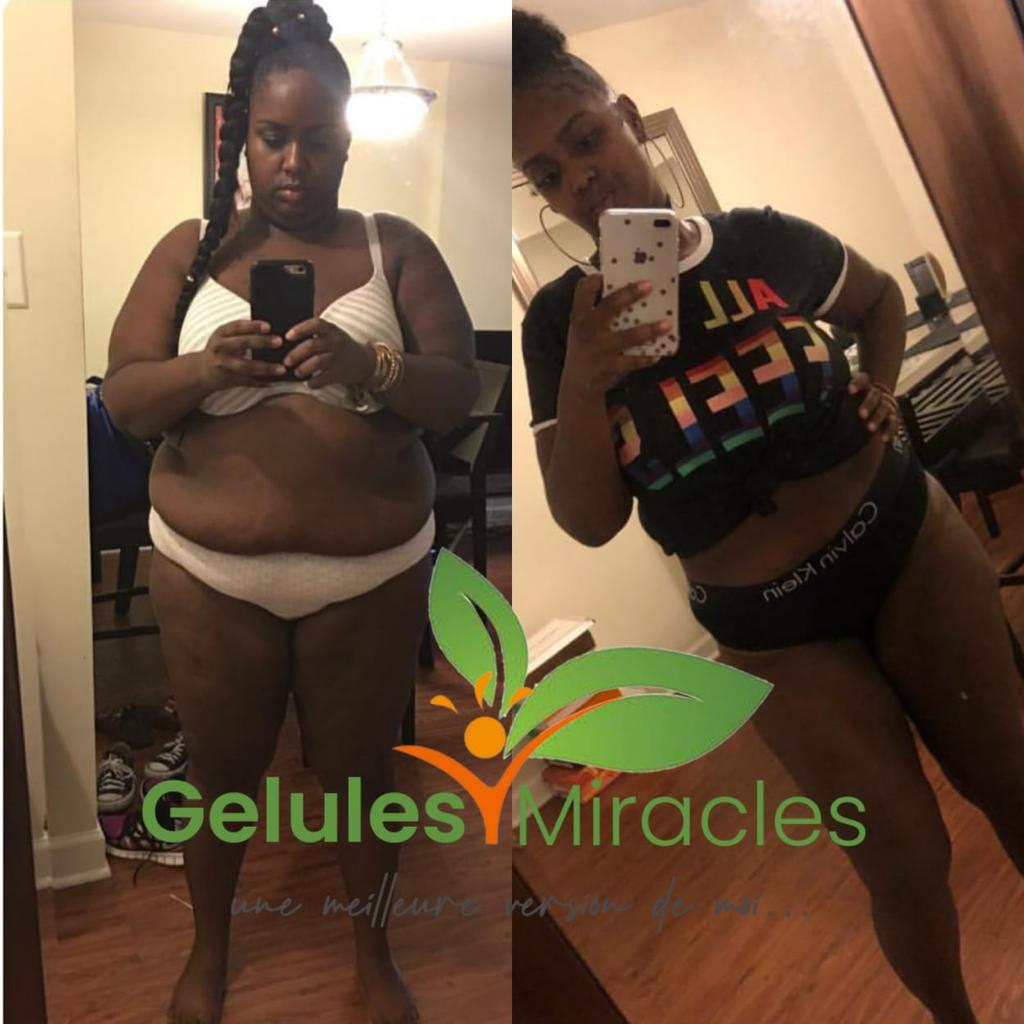 Advanced Weight Loss Gummies Set (Garcinia + ACV Gummies)