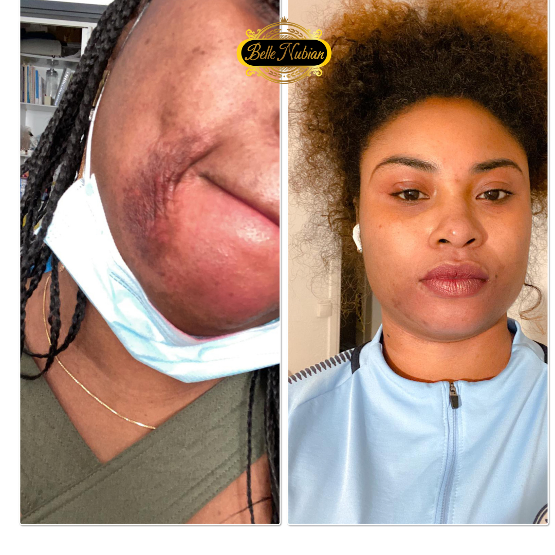 Perfect Face Kit (Kit Visage)