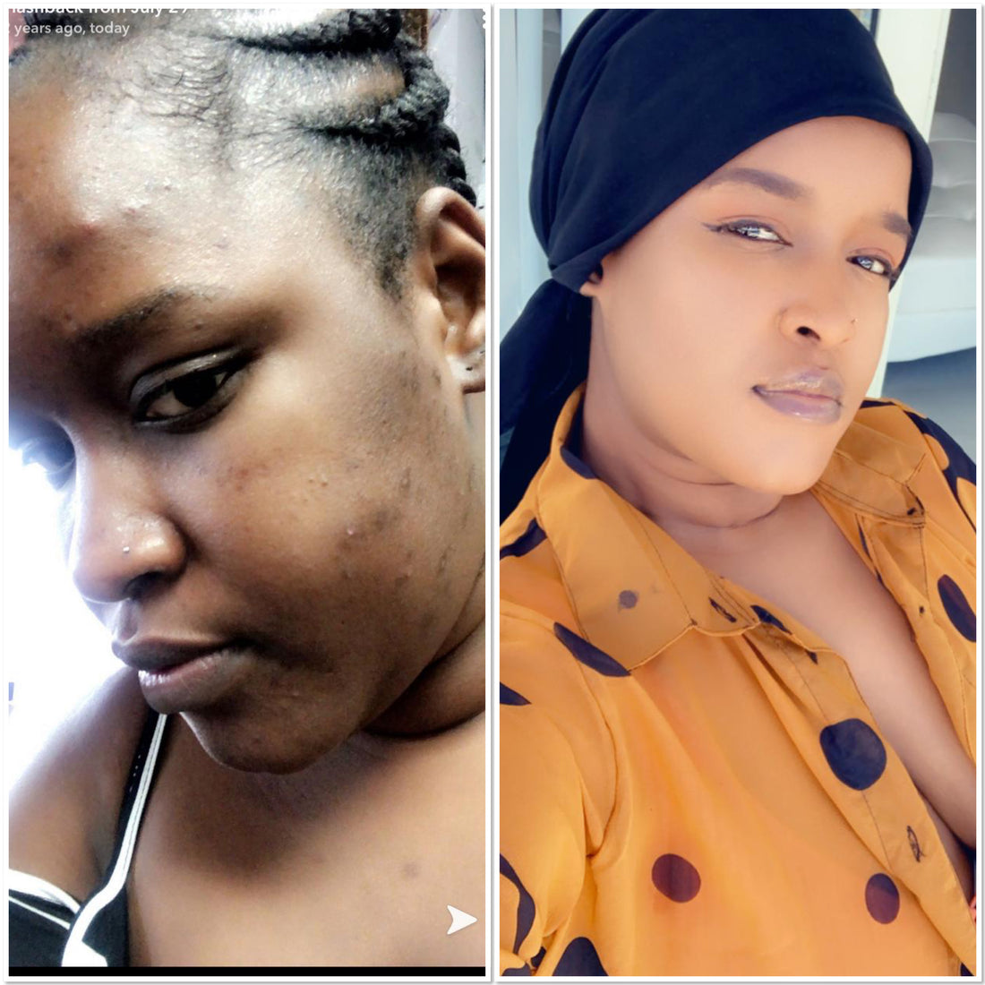 Miracle Extra Light Set (Without Pills)