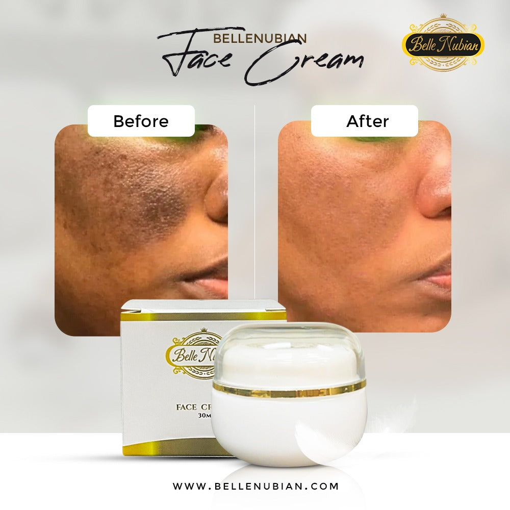 NEW Redness and Burn Face Cream