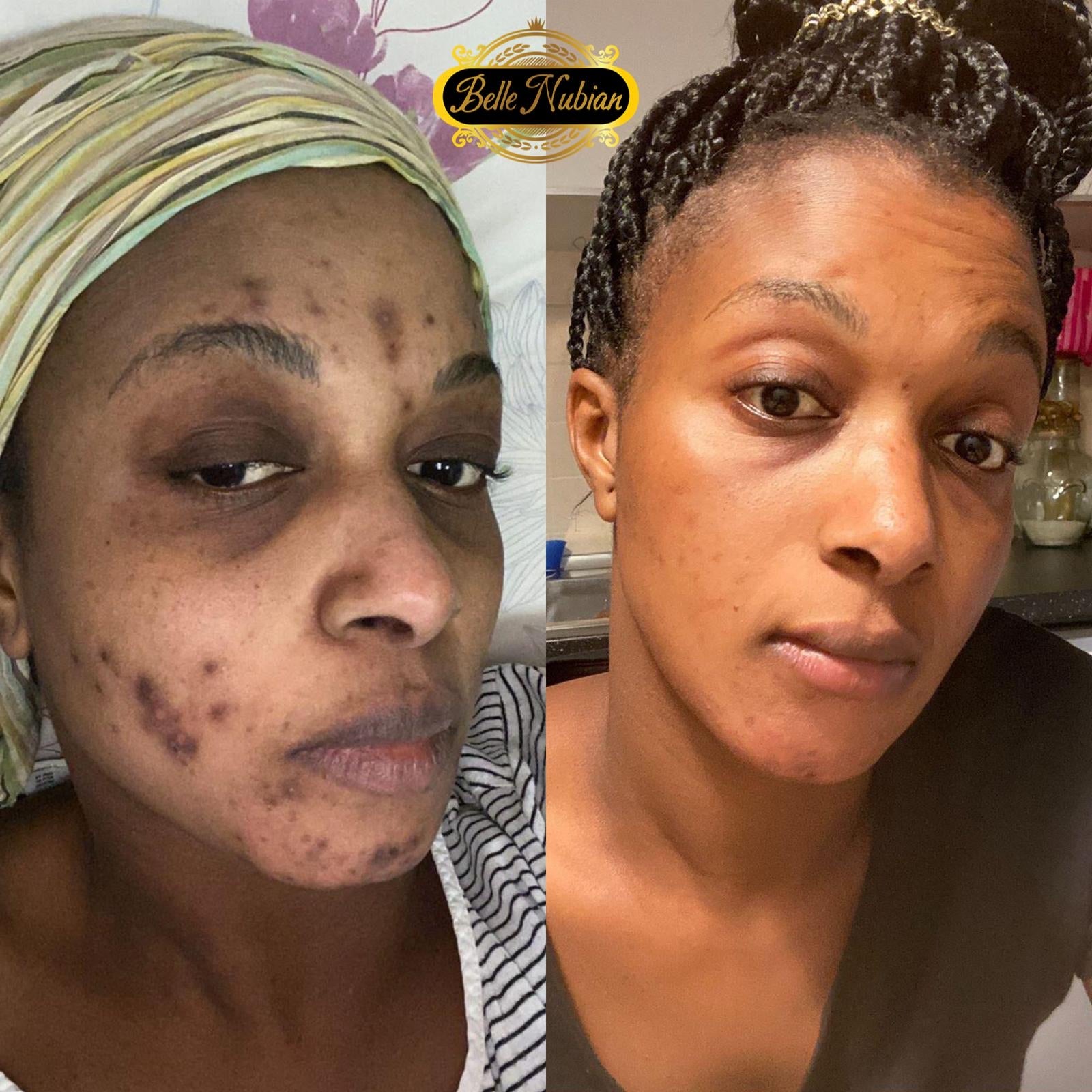 Perfect Face Kit (Kit Visage)