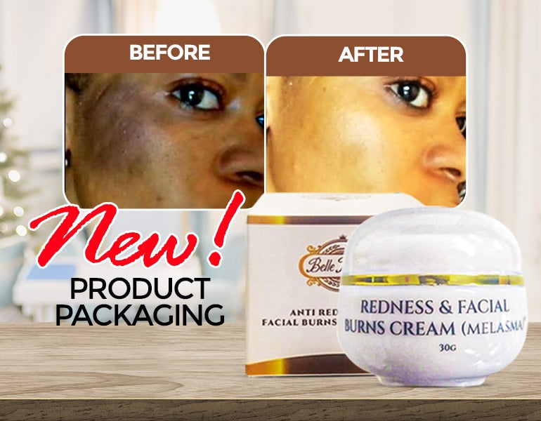 NEW Redness and Burn Face Cream